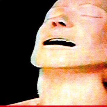 Thumbnail for Episode 2343: Second Album Syndrome with Steven Routledge Part One: Radiohead’s The Bends